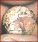 Eclosion